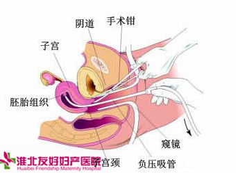 什么原因?qū)е屡悦庖咝圆辉? height=
