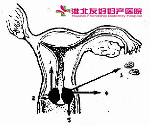 如何檢查宮頸癌的發(fā)生呢?