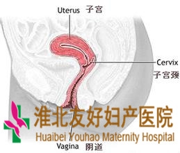 宮頸癌應(yīng)該做哪些檢查